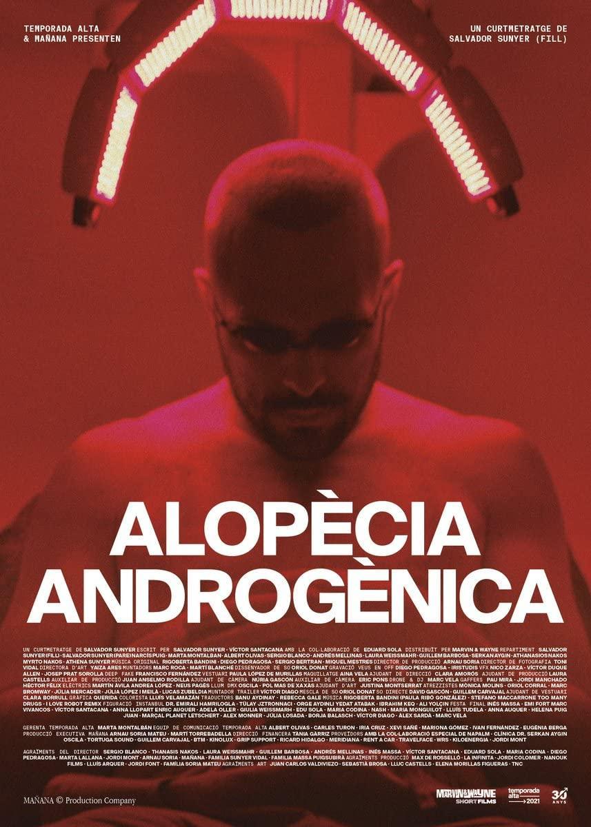 Alopècia androgènica (C)