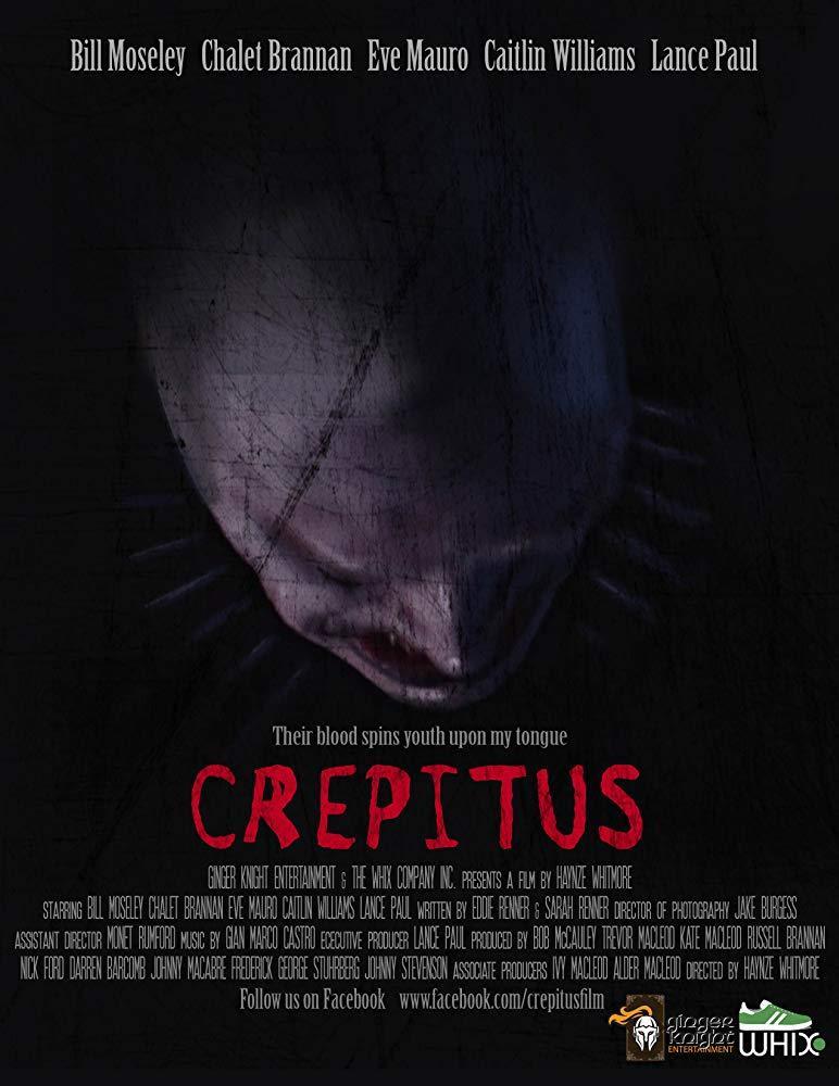 Crepitus