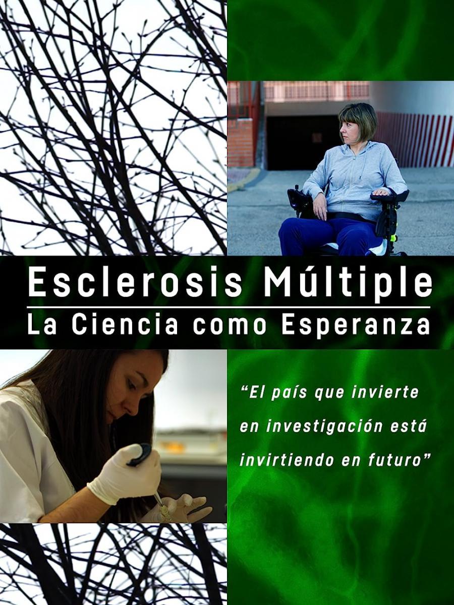 Esclerosis múltiple, la ciencia como esperanza