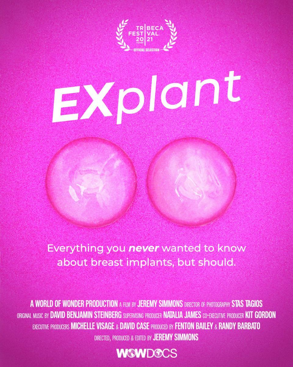 Explant