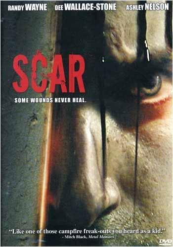 Scar