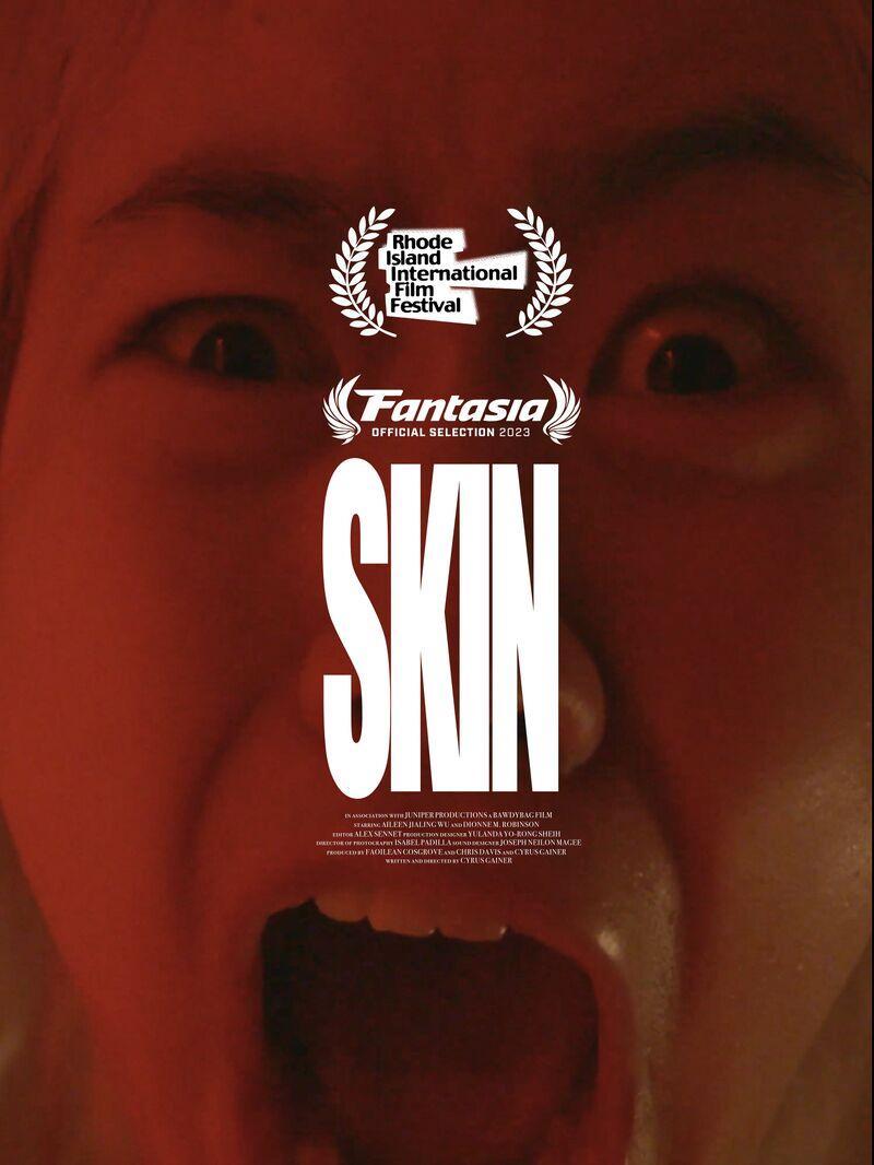 Skin